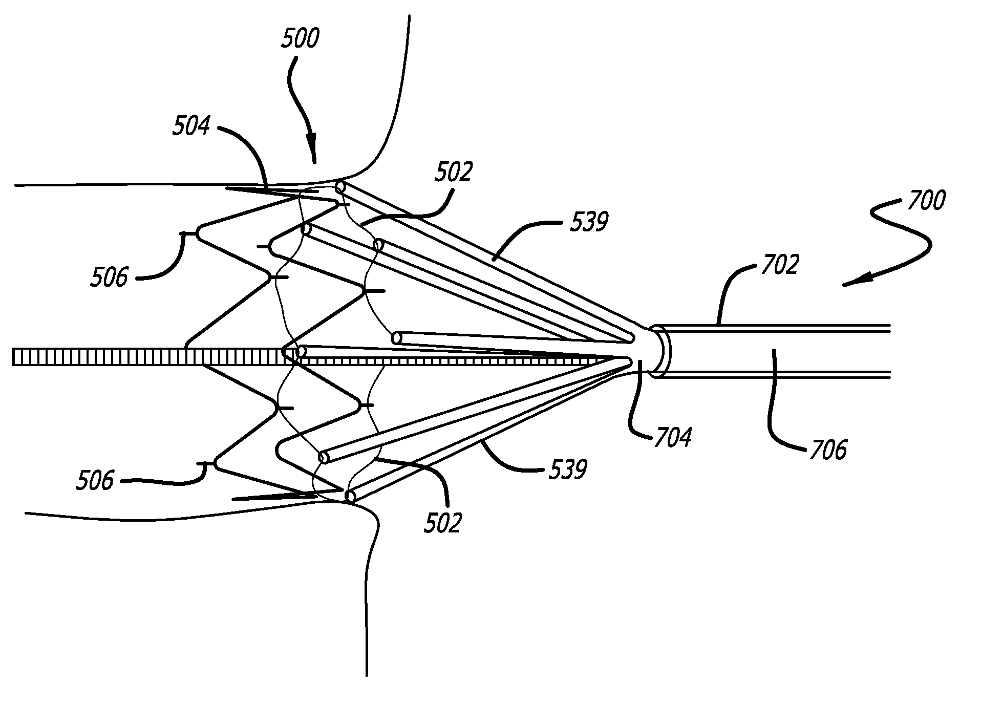 Electrical Conduction Block Implant Device