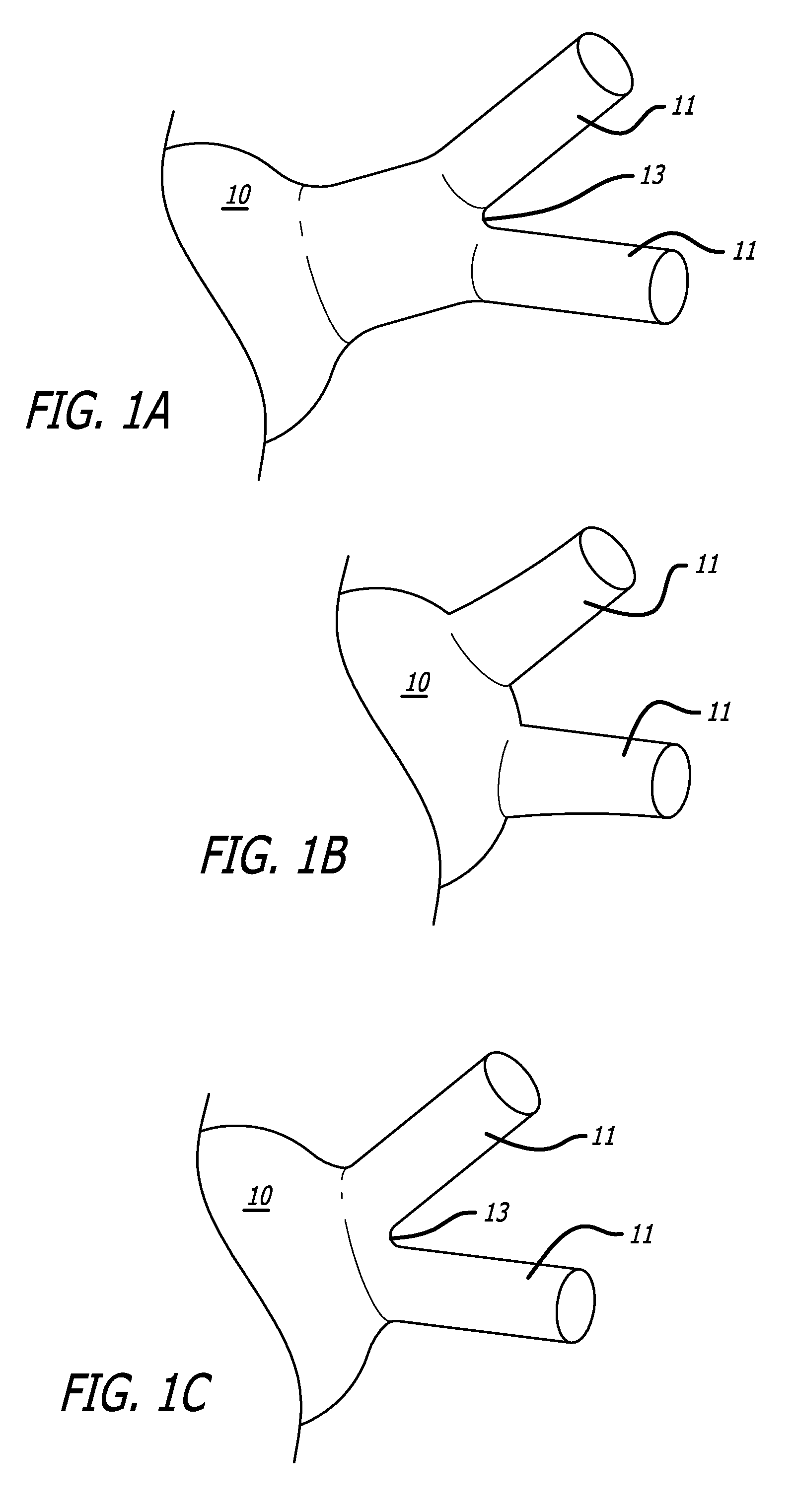 Electrical Conduction Block Implant Device
