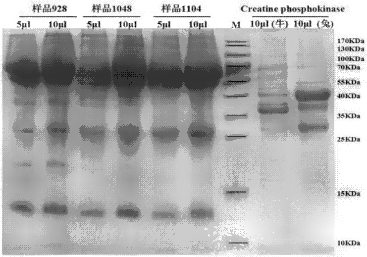 Bovine derived creatine kinase isoenzyme double-antibody sandwich ELISA (enzyme-linked immuno sorbent assay) rapid detection kit