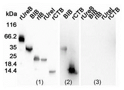 Intramolecular adjuvant-containing recombinant gene for preventing and treating helicobacter pylori, protein and biological product