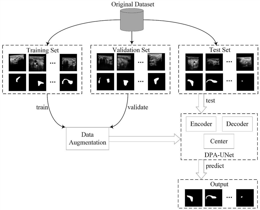 A medical image segmentation method based on deep learning