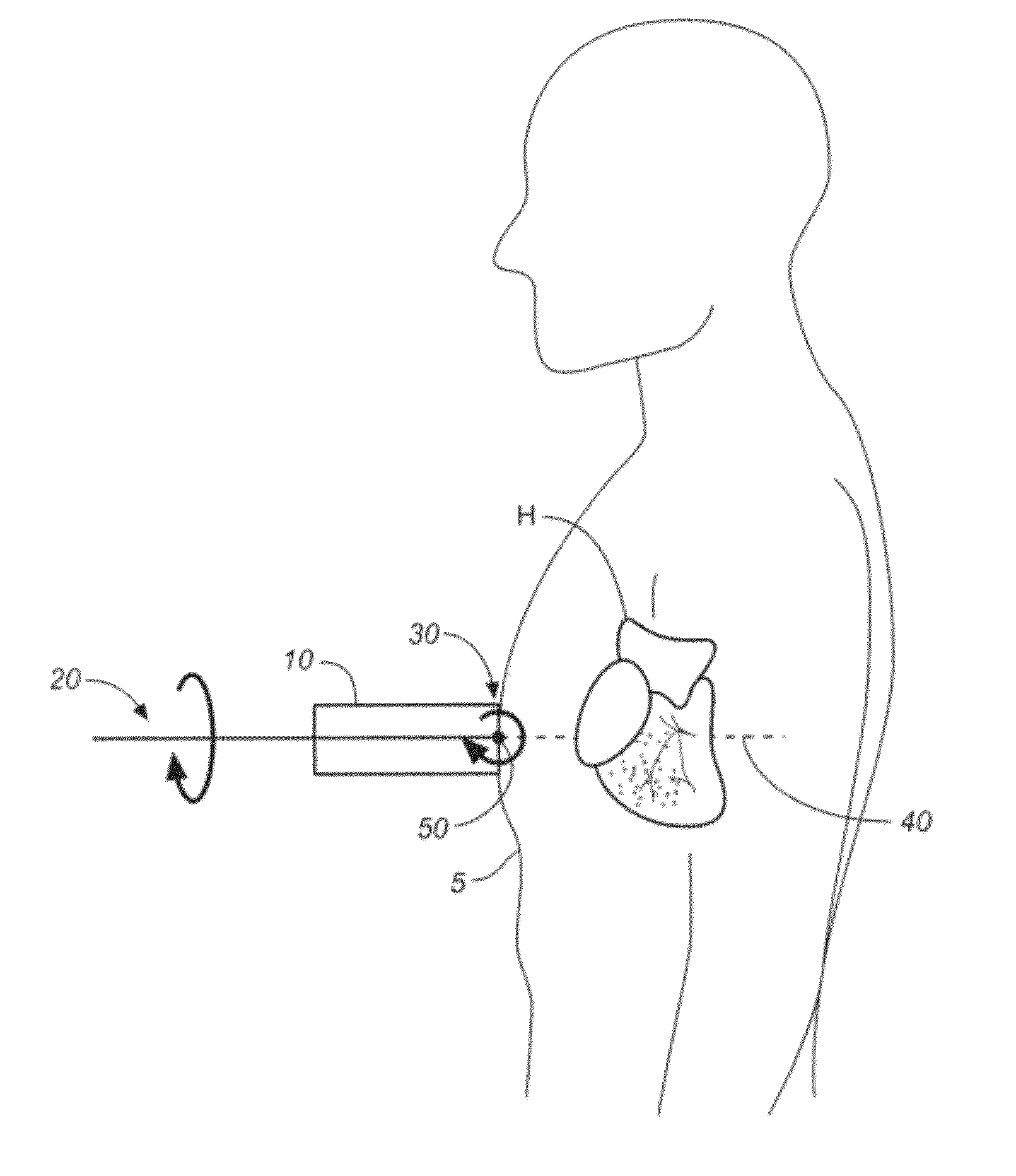 Method and Apparatus to Visualize the Coronary Arteries Using  Ultrasound