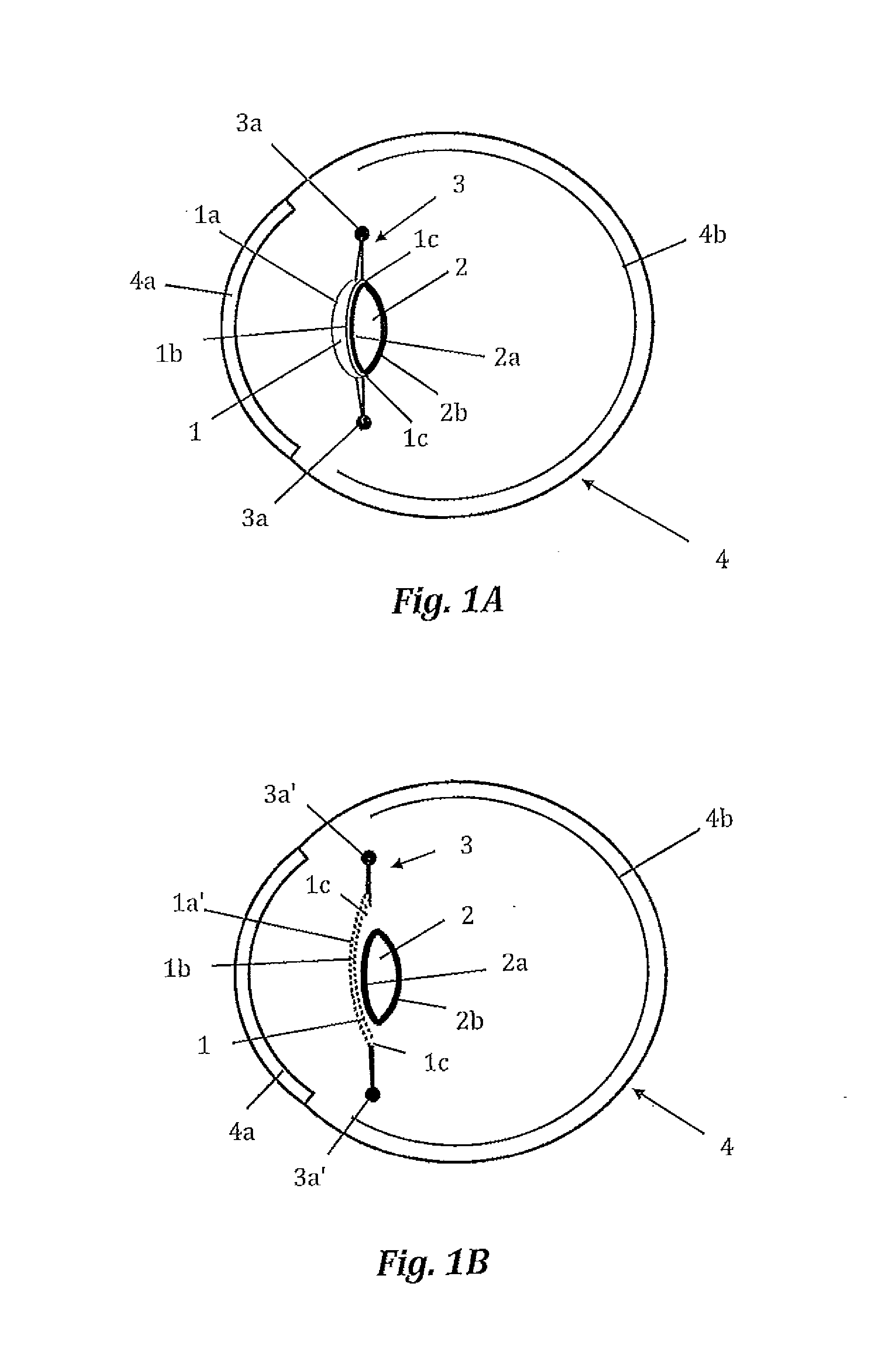 Intraocular lens with accommodation capacity