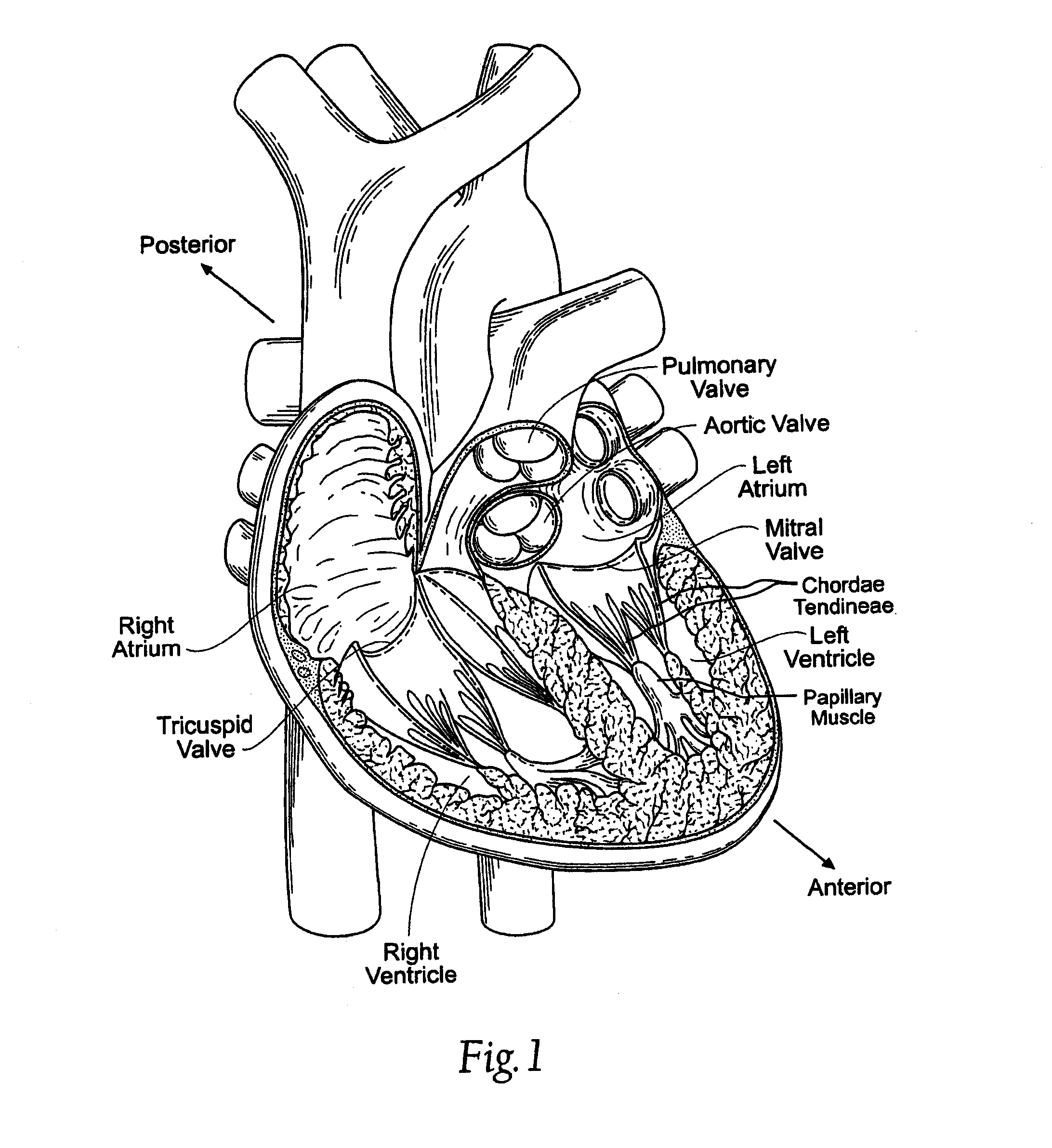 Methods of implanting a heart valve at an aortic annulus