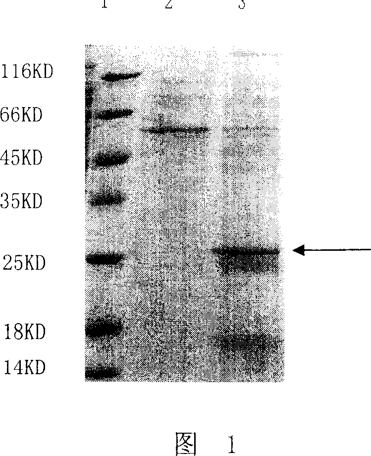 Snake venom thrombin-like enzyme and its encoding gene and application