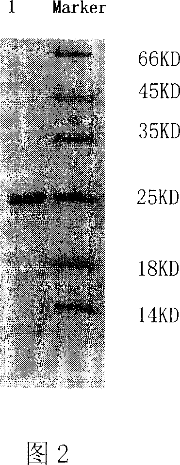 Snake venom thrombin-like enzyme and its encoding gene and application