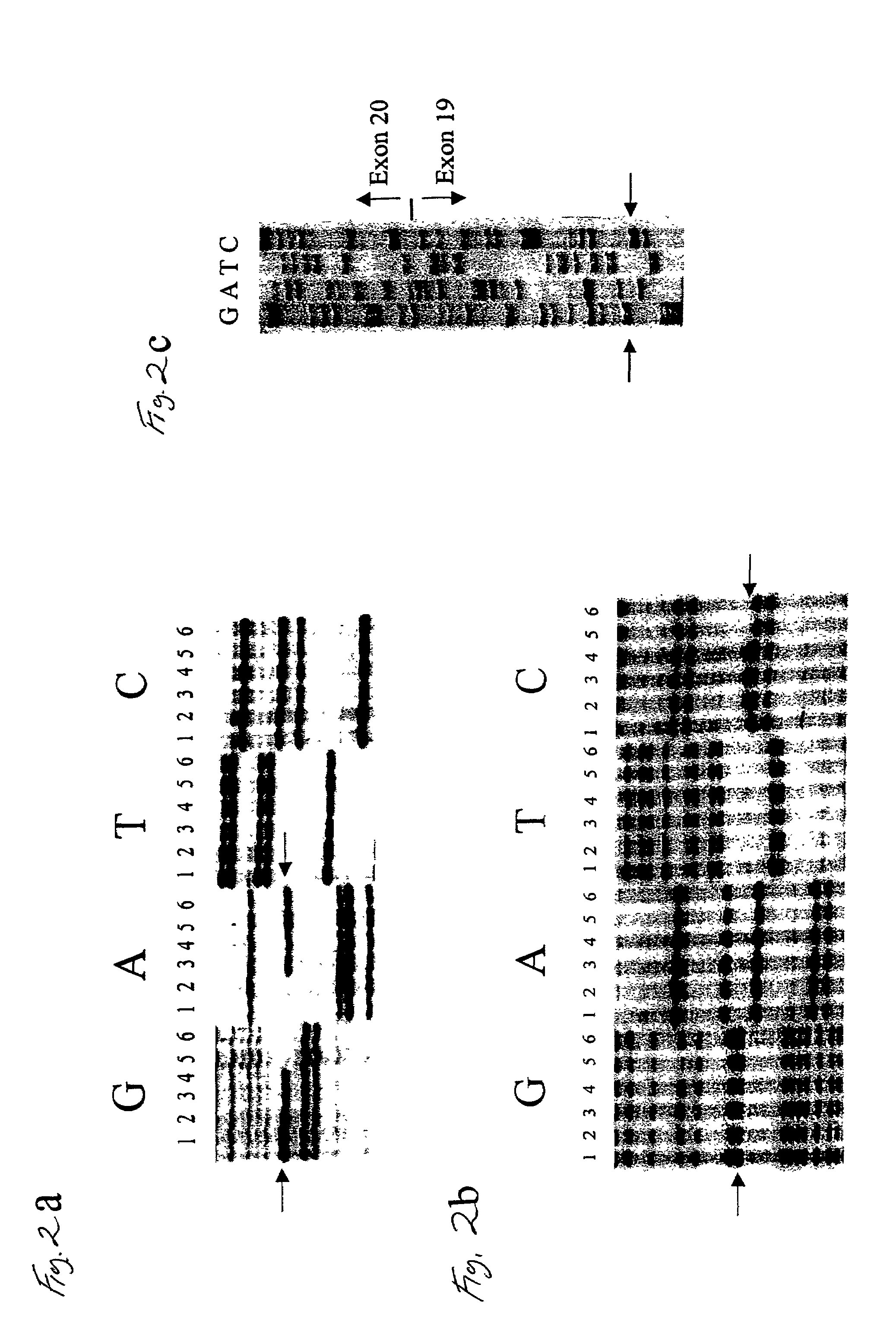 Gene for identifying individuals with familial dysautonomia