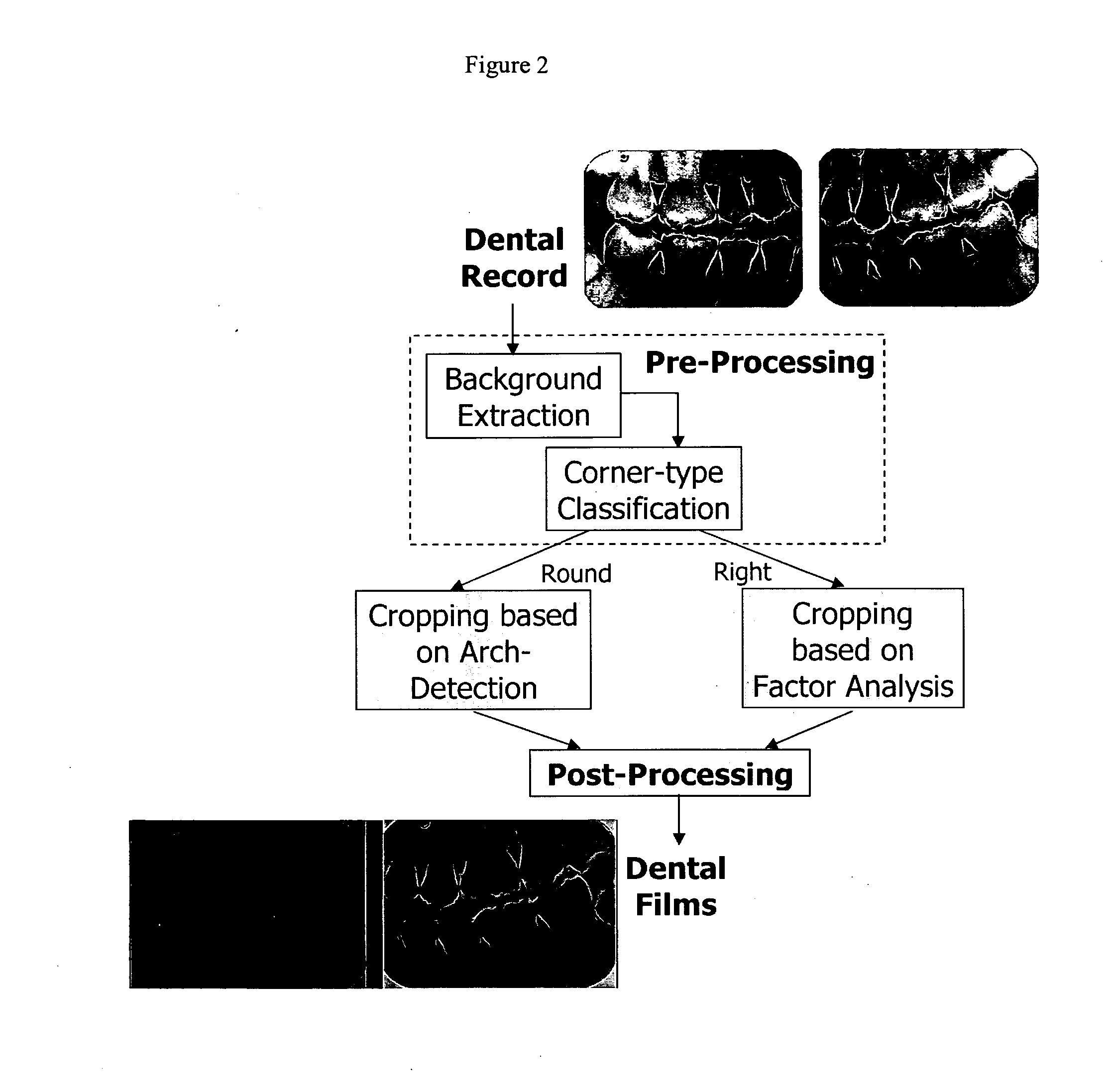 Automated dental identification system