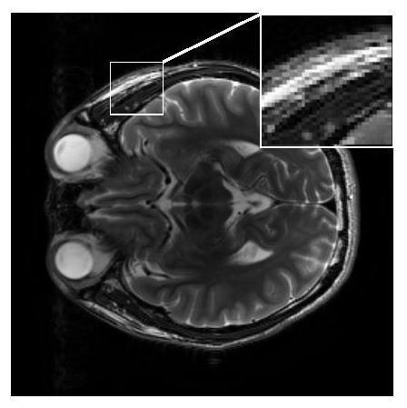 CS-MRI image reconstruction method based on sparse manifold joint constraint