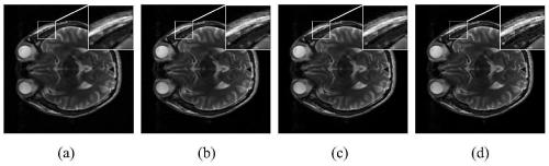 CS-MRI image reconstruction method based on sparse manifold joint constraint