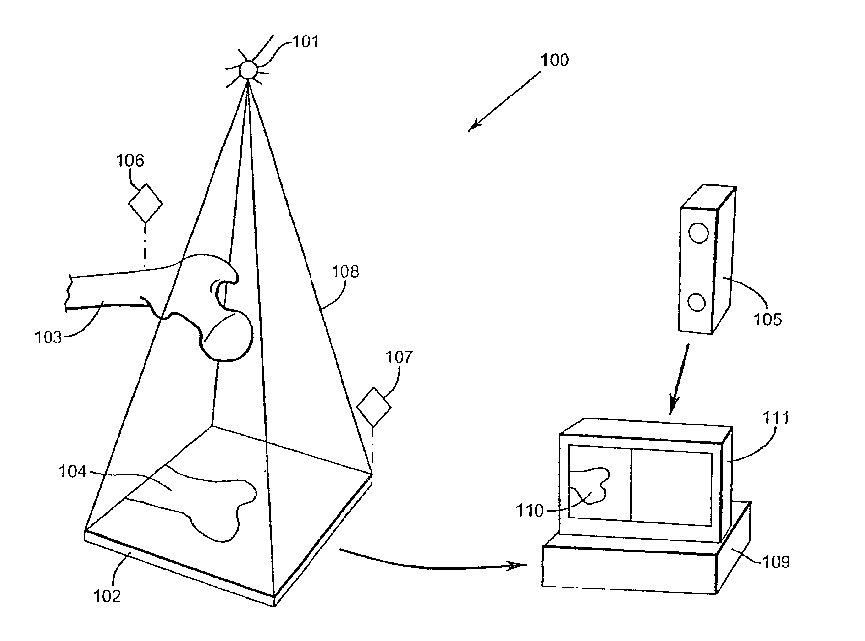 Apparatuses and methods for surgical navigation