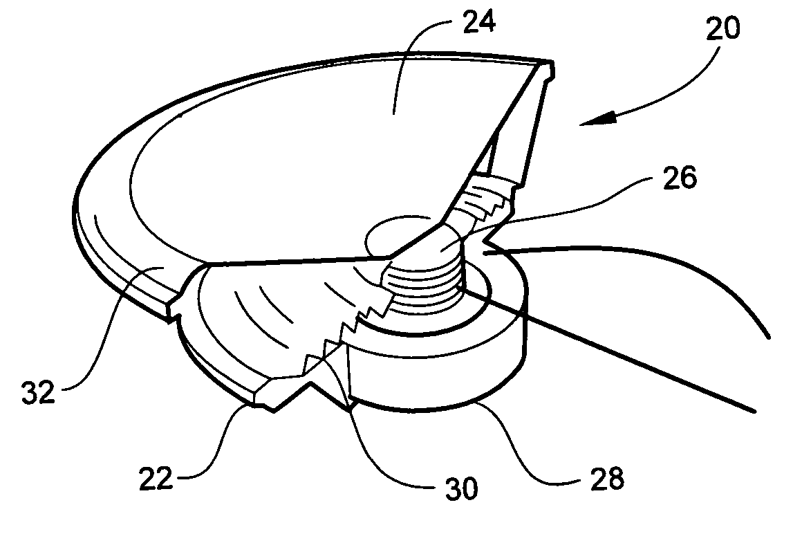 Tangential stress reduction system in a loudspeaker suspension