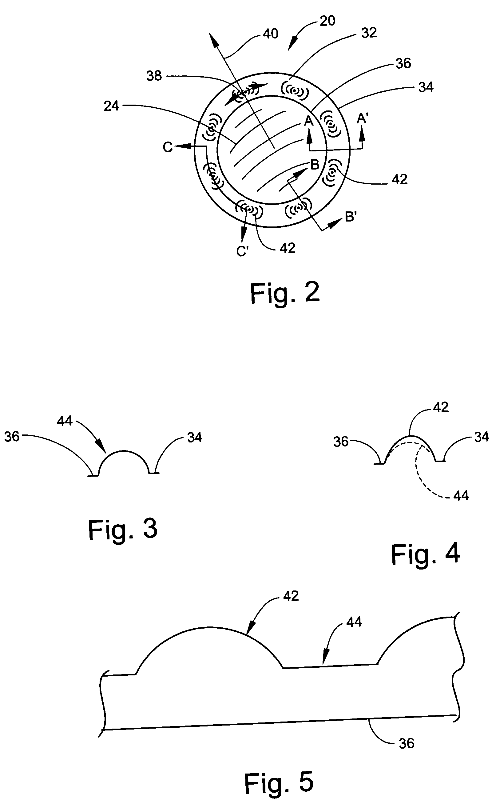 Tangential stress reduction system in a loudspeaker suspension