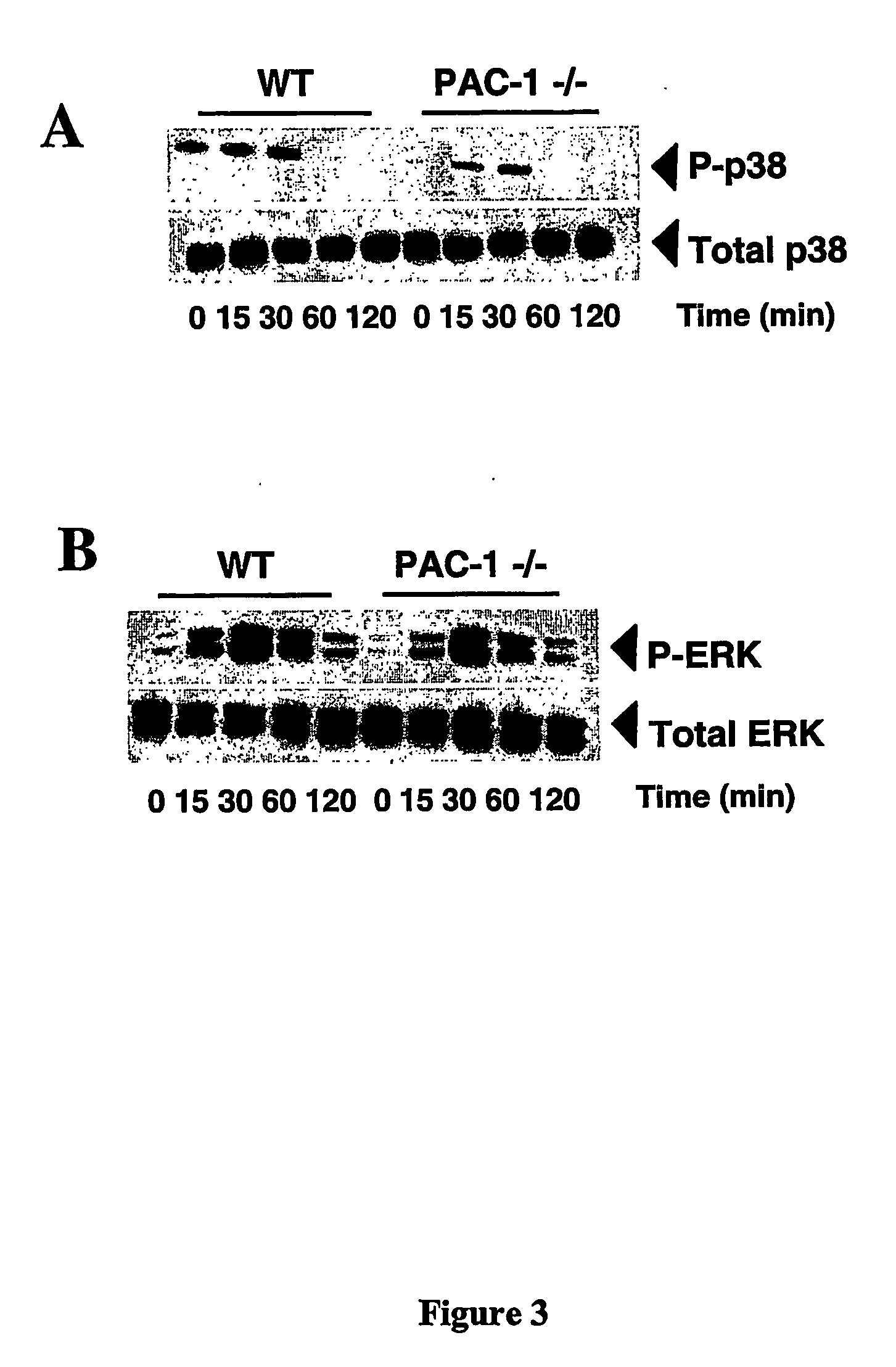 Methods of diagnosing and treating inflammatory diseases using pac-1 (dusp2)