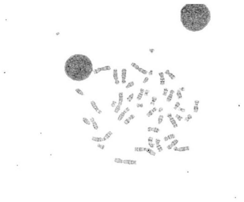 Chromosome scatter image automatic segmentation method