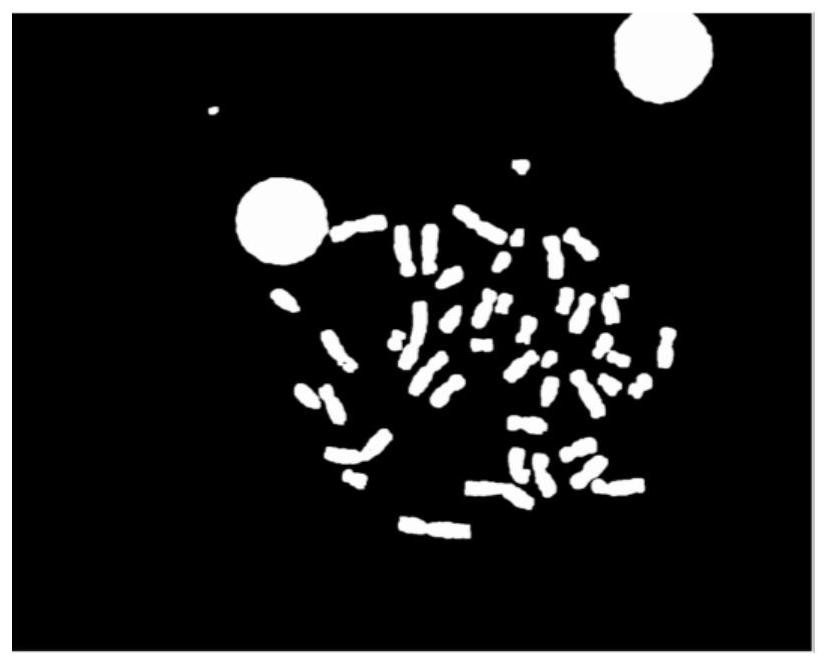 Chromosome scatter image automatic segmentation method