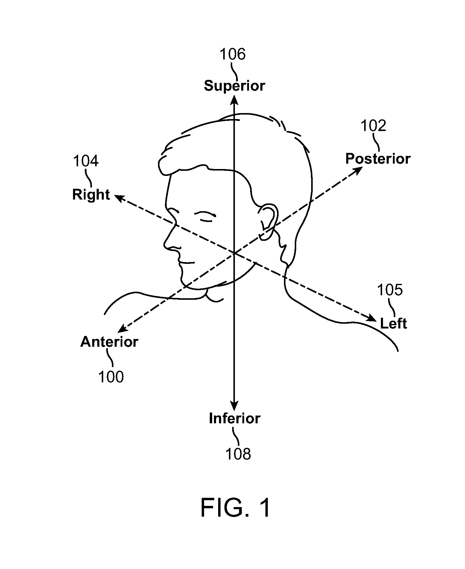 Delivery Tools for Sleep Disorders Treatment Implant and Methods of Implantation