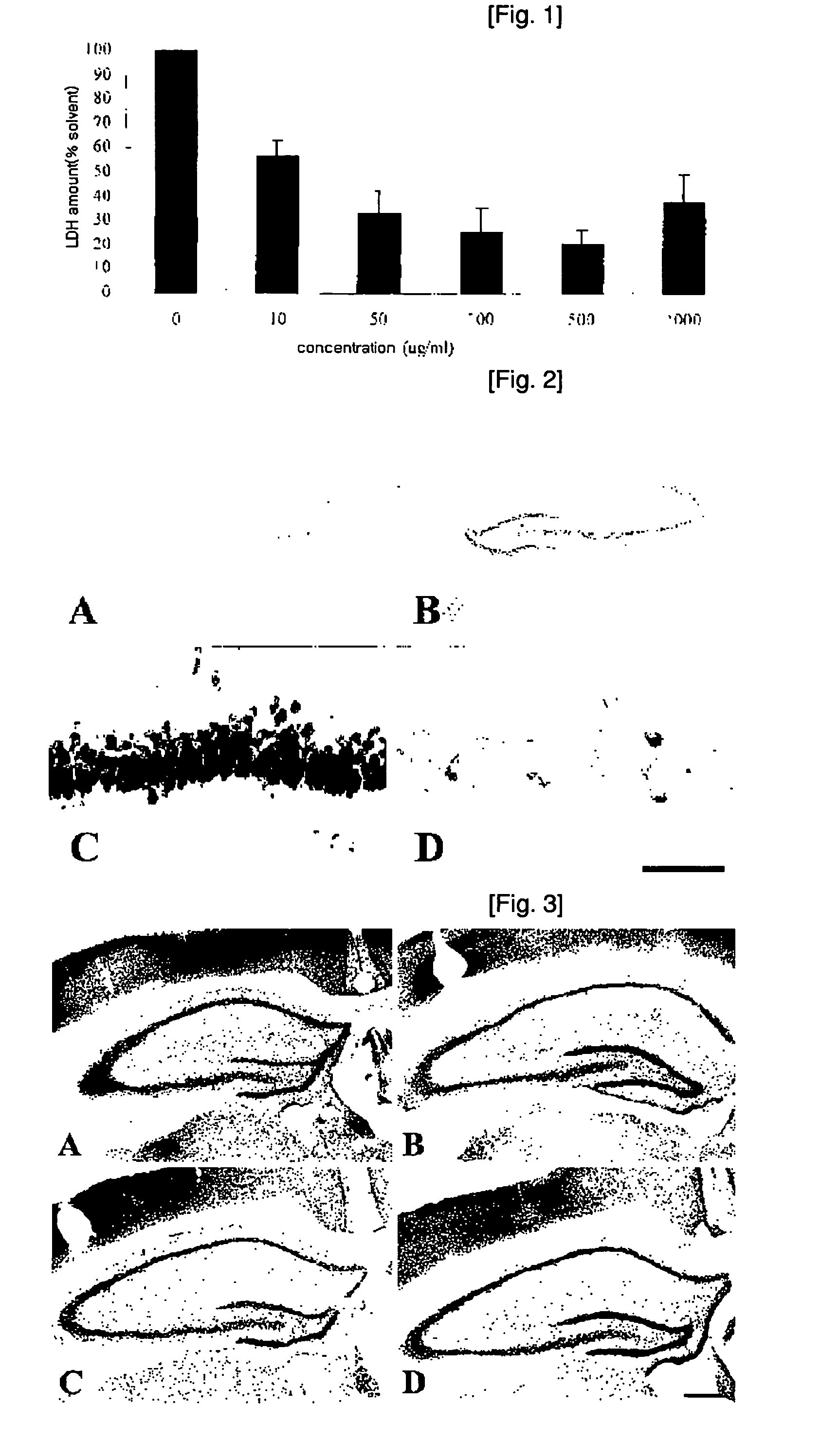 Grape seed extract having neuronal cell-protection activity and the composition comprising the same for preventing and treating degenerative brain disease
