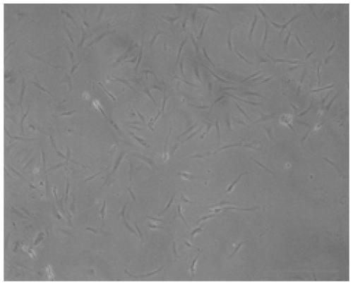 Isolation and culture of preadipocytes from croaker and its induction method