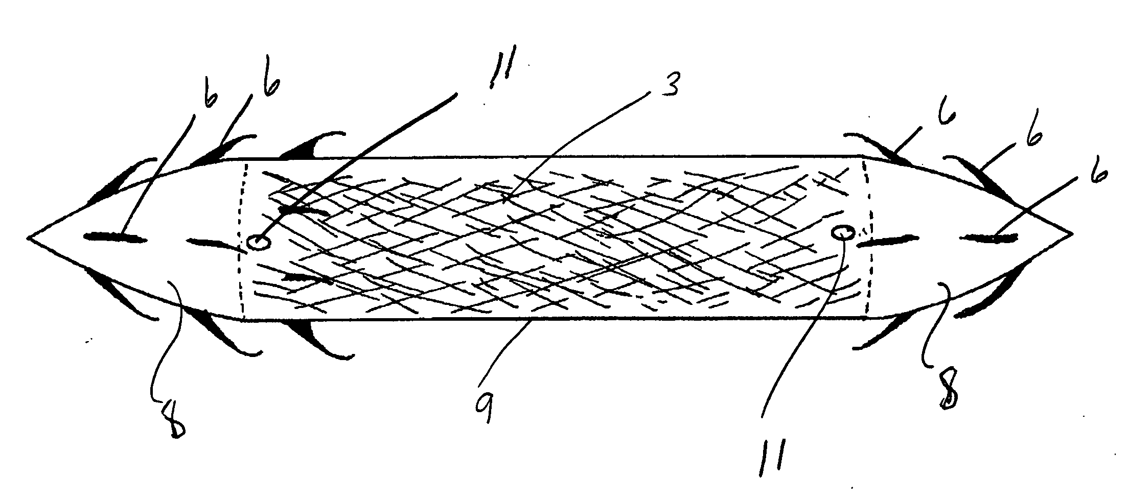 Surgical instrument for treating female pelvic prolapse