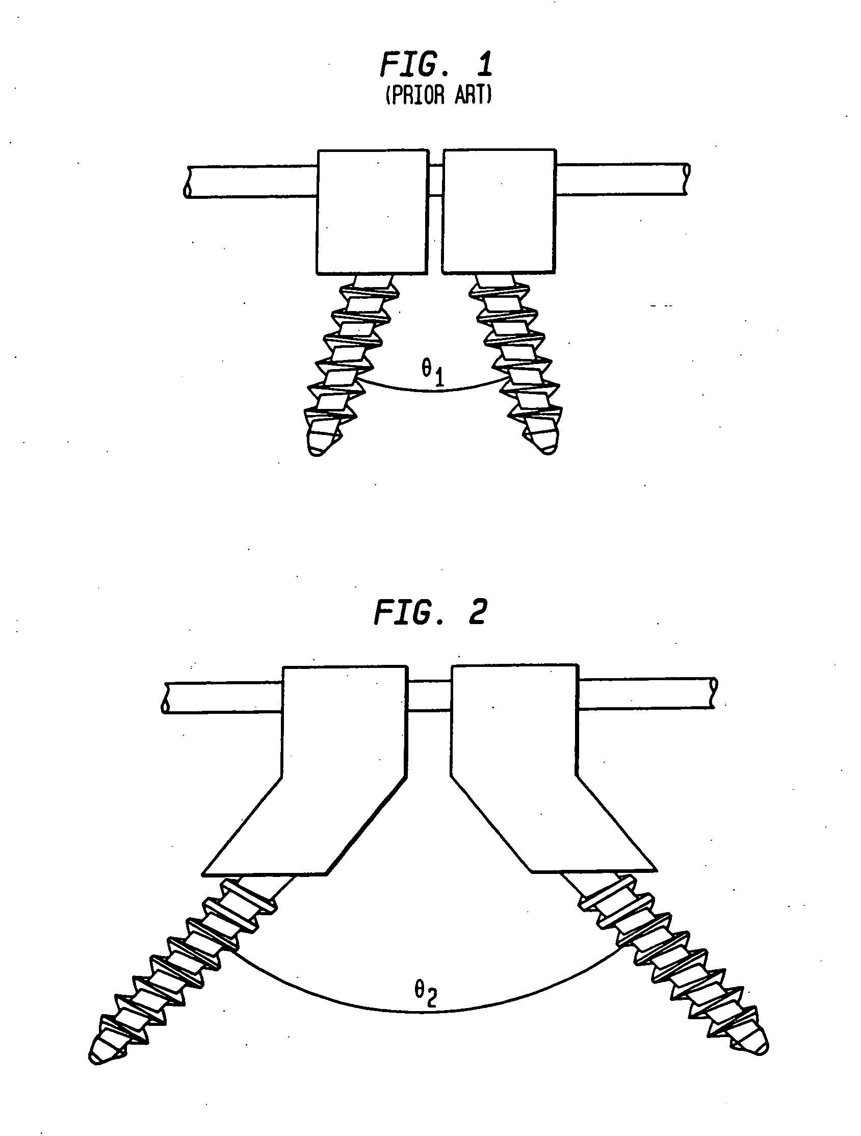 Methods for stabilizing bone using spinal fixation devices