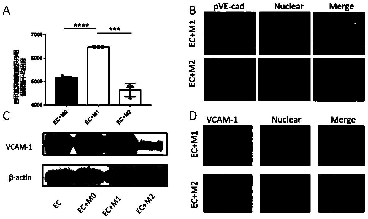 Application of macrophage in blood vessel barrier protection, and prevention, inhibition and treatment of ovarian cancer ascites