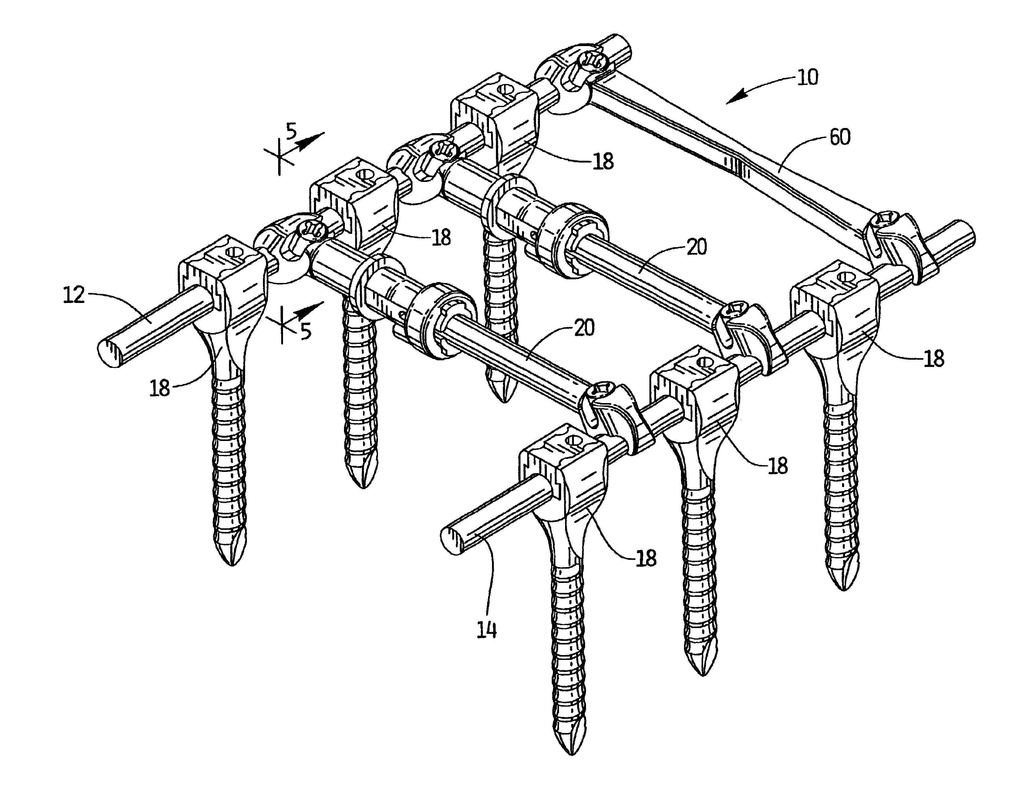 Apparatus for spinal stabilization