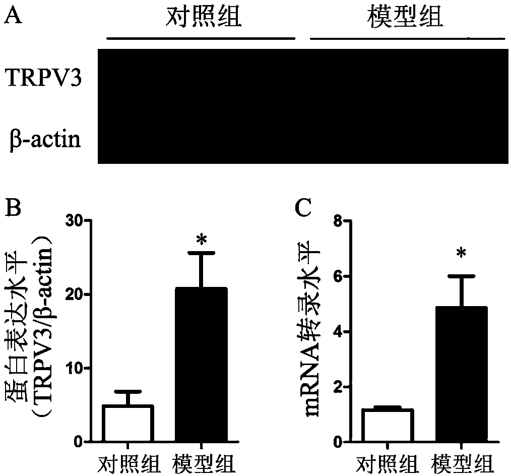 Application of transient receptor potential cation channel TRPV3 in development of medicines for preventing or treating psoriasis