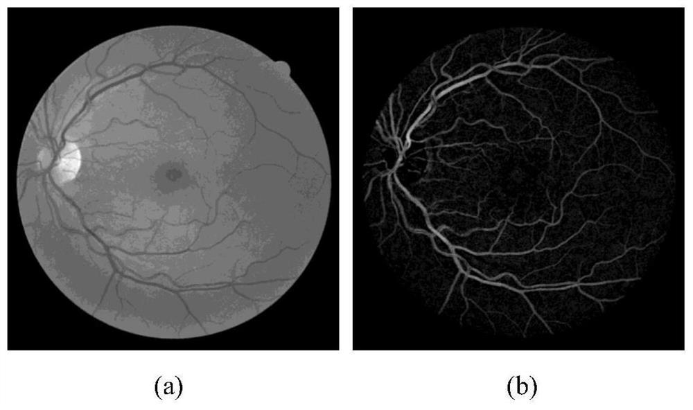 Fundus image blood vessel segmentation method based on coupled neural network and line connector