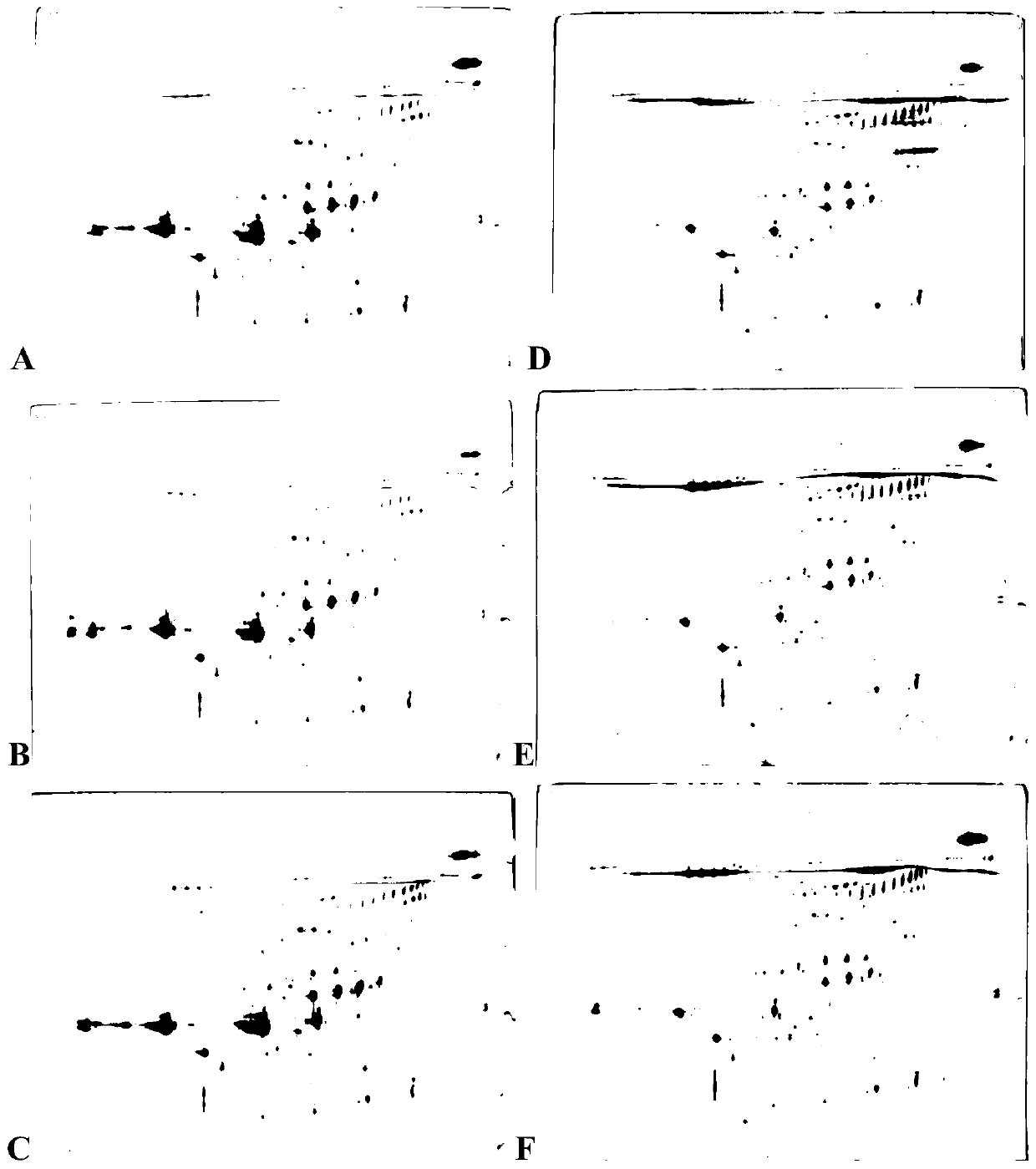 Biomarkers for diagnosing mucopolysaccharidosis type II (MPS II) and application thereof