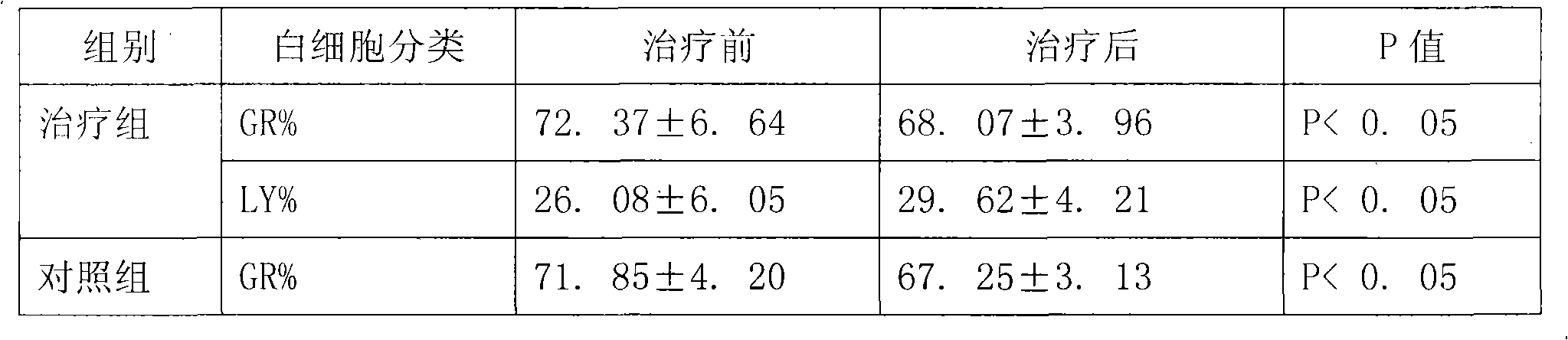 Traditional Chinese medicine composition for treating pharyngitis and preparation method thereof