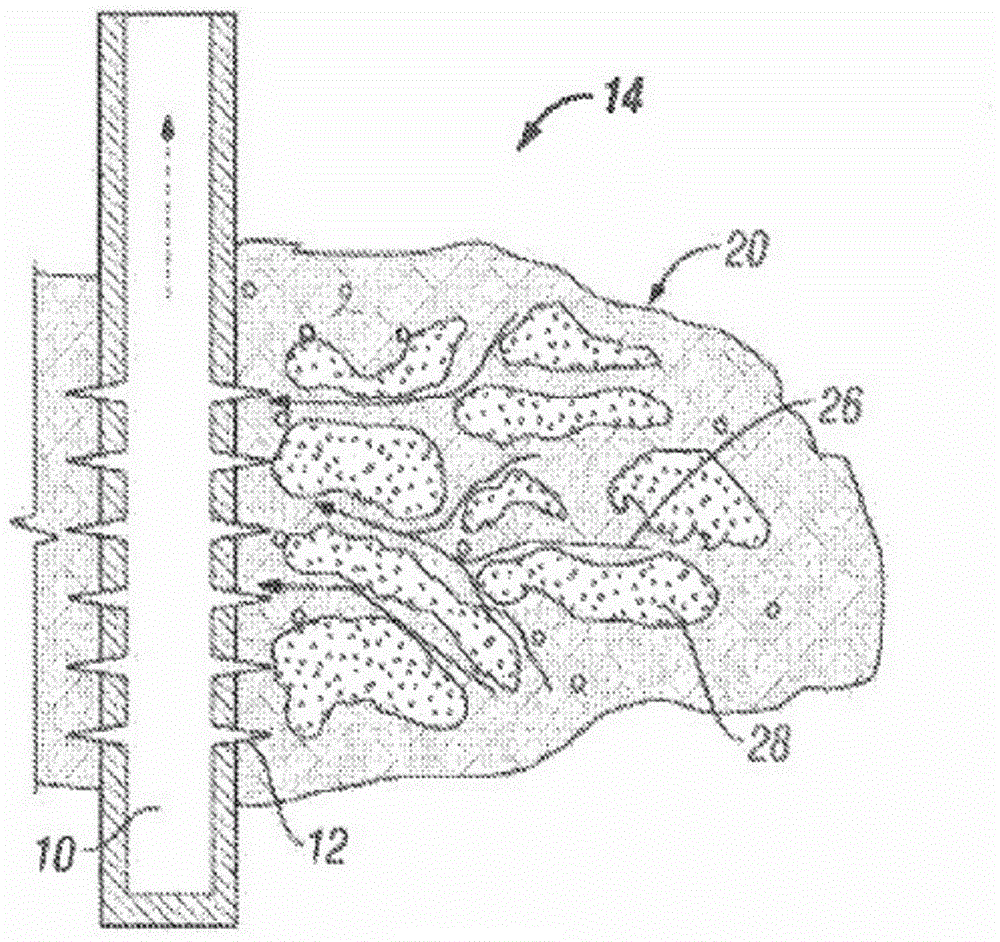 Uneven placement of proppants in fractures with removable extrametric material fills