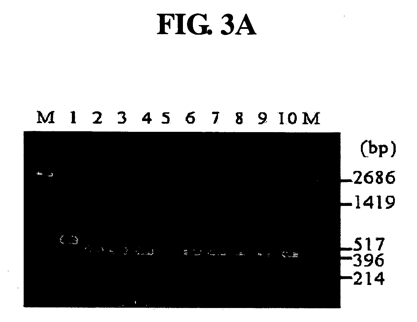 Diagnostic method for cancer characterized in the detection of the deletion of G-CSF exon 3