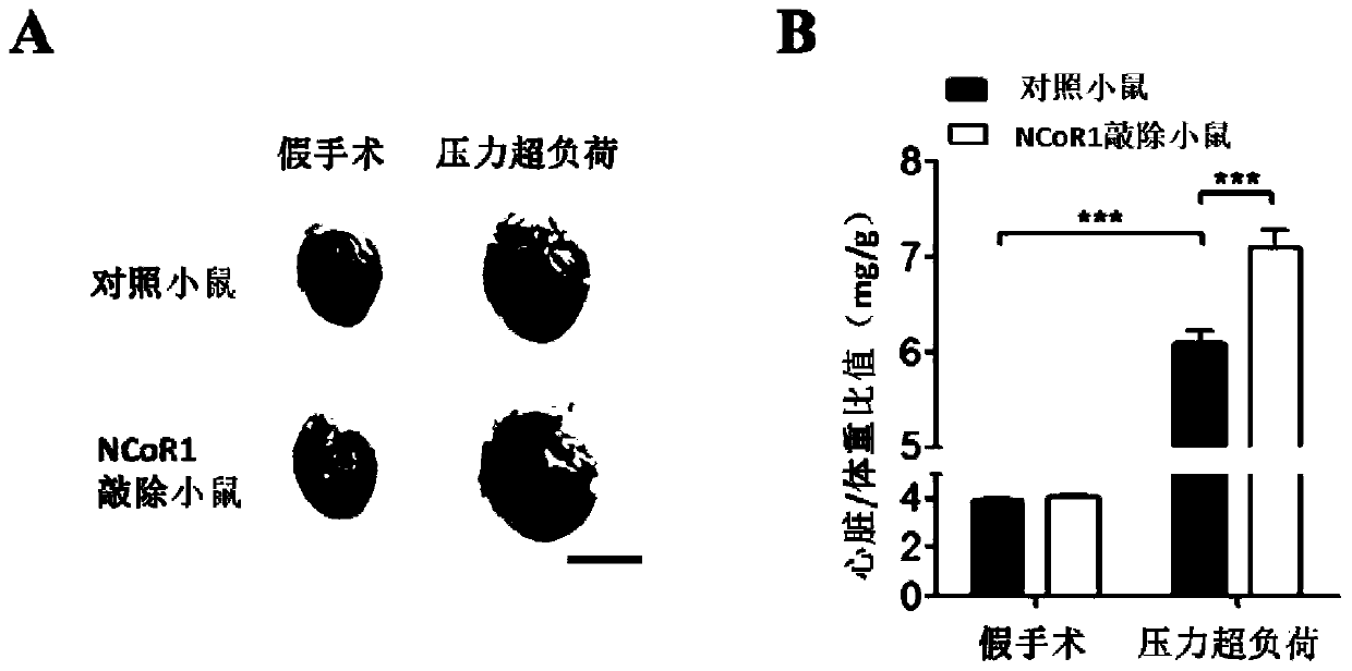 Polynucleotide and application of same in diagnosis and treatment of cardiovascular diseases