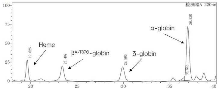 Beta-globin recombinant lentiviral vector and application thereof