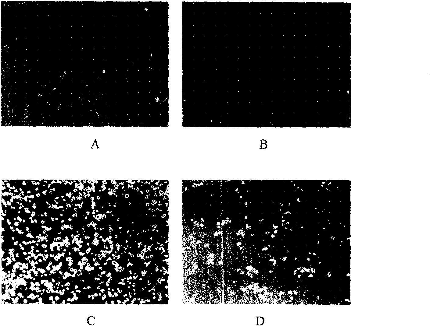 Method for sorting primary human marrow mesenchymal steam cell by monoclonal antibody ZUC3 immunomagnetic bead