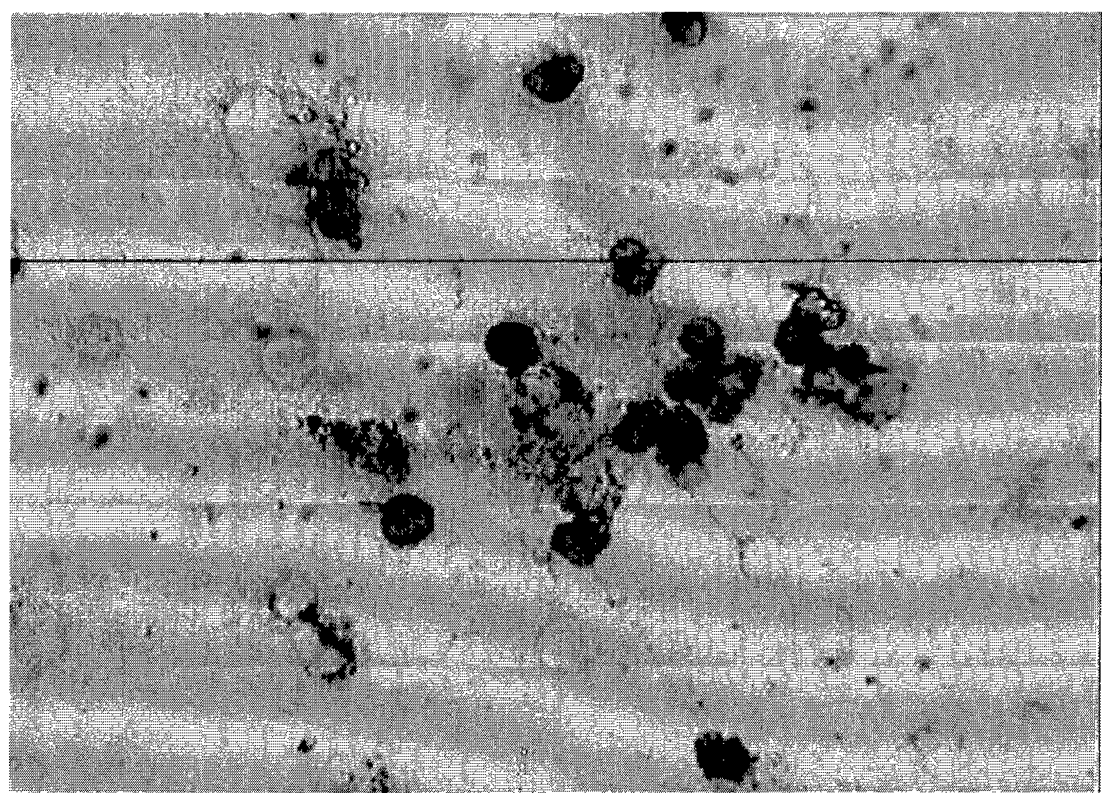 In situ hybridization detection kit for early carcinoma of prostate, detecting method and use thereof