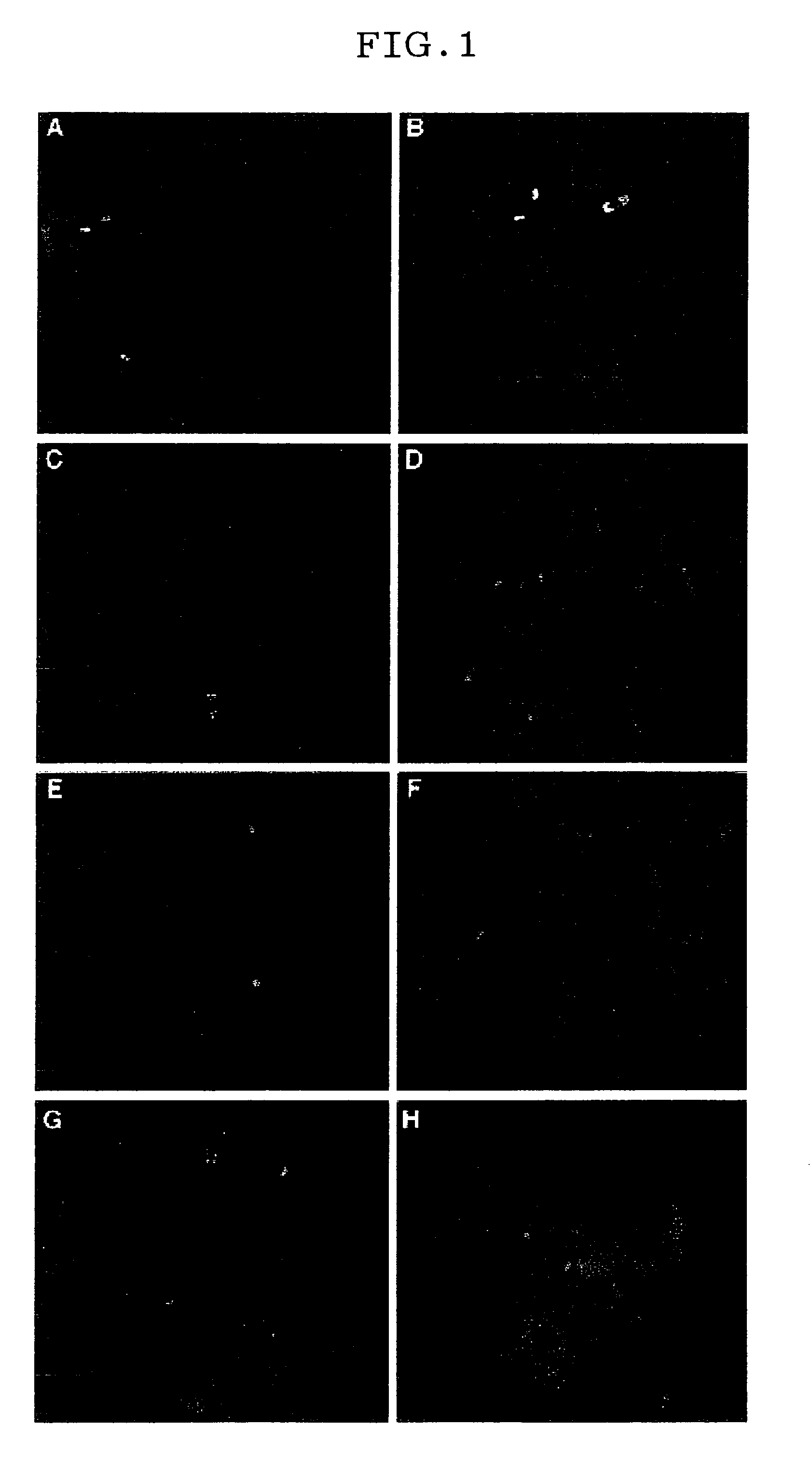 Method of detecting cancer cell acquiring drug-resistance