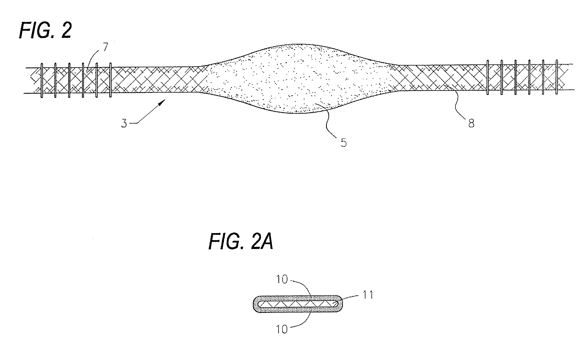Surgical instrument for treating female urinary stress incontinence