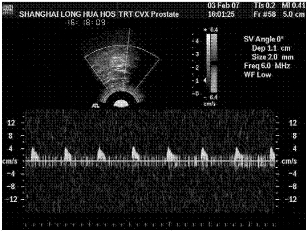 A hip surface measurement and normal pressure diagnosis and treatment system