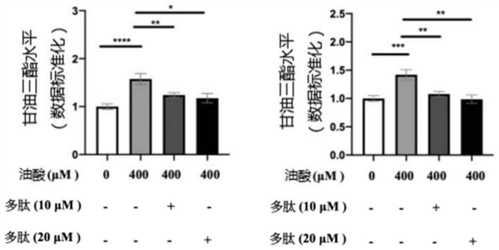 A polypeptide applied to inhibit intracellular lipid accumulation and its synthesis method