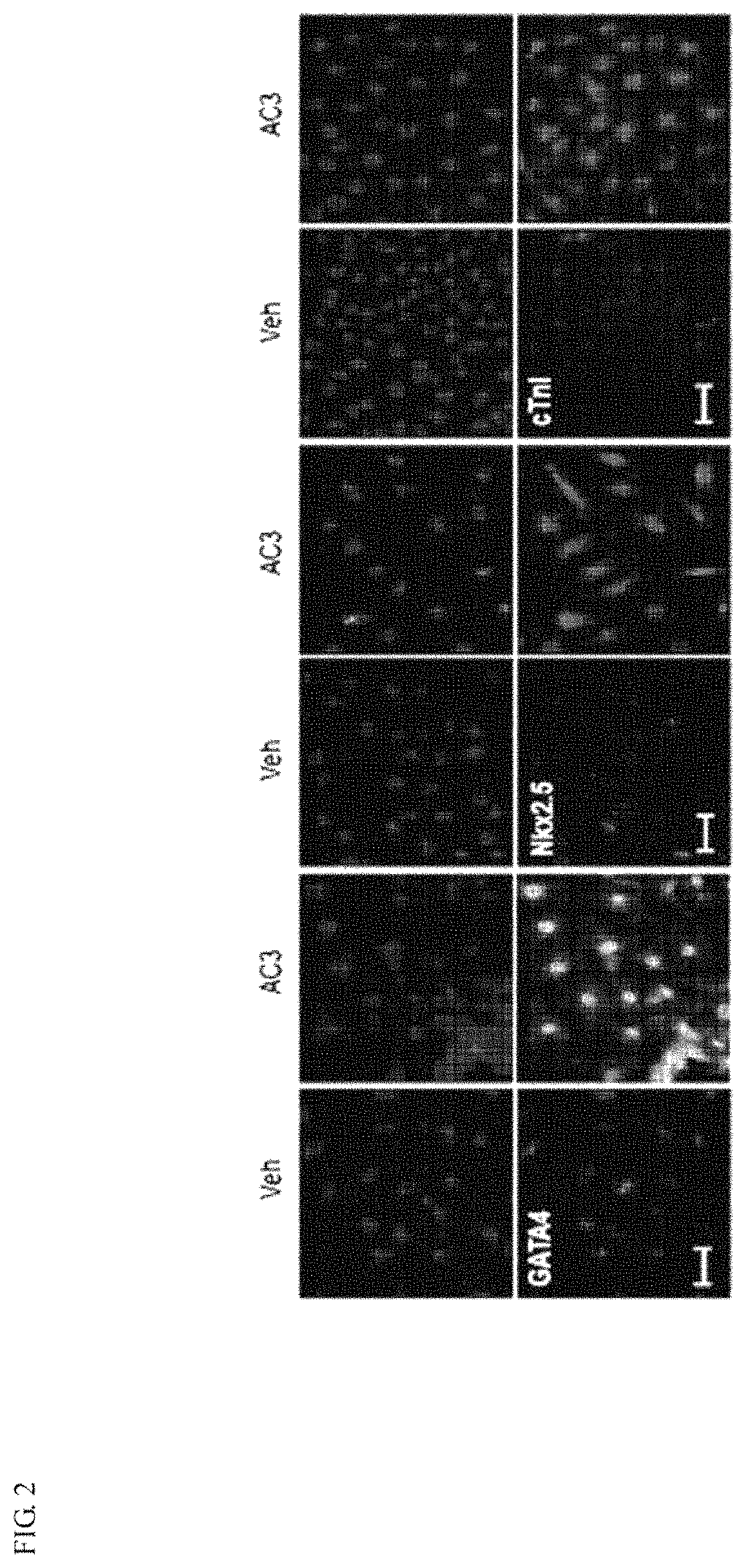 Apicidin-containing composition for inducing differentiation of mesenchymal stem cells into cardiac-committed cells