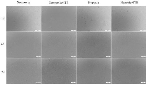 Application of ITE in preparation of drugs for preventing and/or treating cardiopulmonary circulatory system diseases