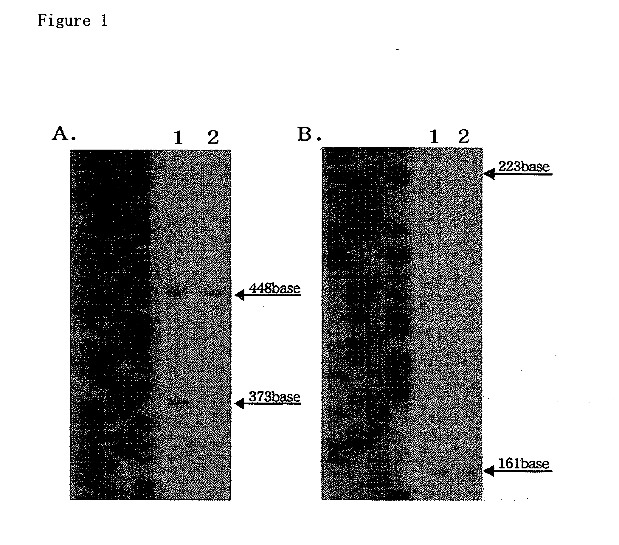 Method of stabilizing reagent for amplifying or detecting nucleic acid and storage method