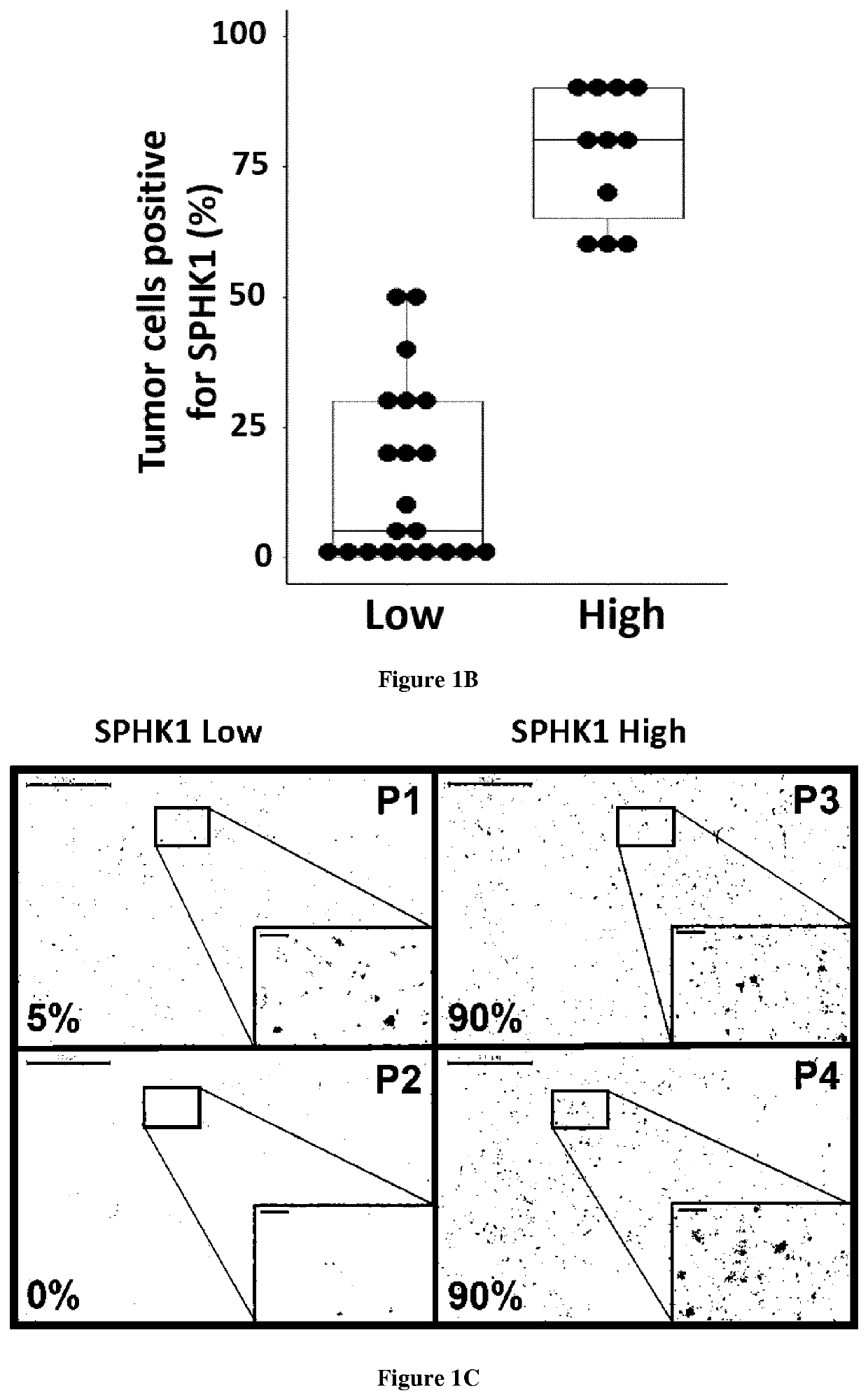 Use of sk1 as biomarker for predicting response to immunecheckpoint inhibitors