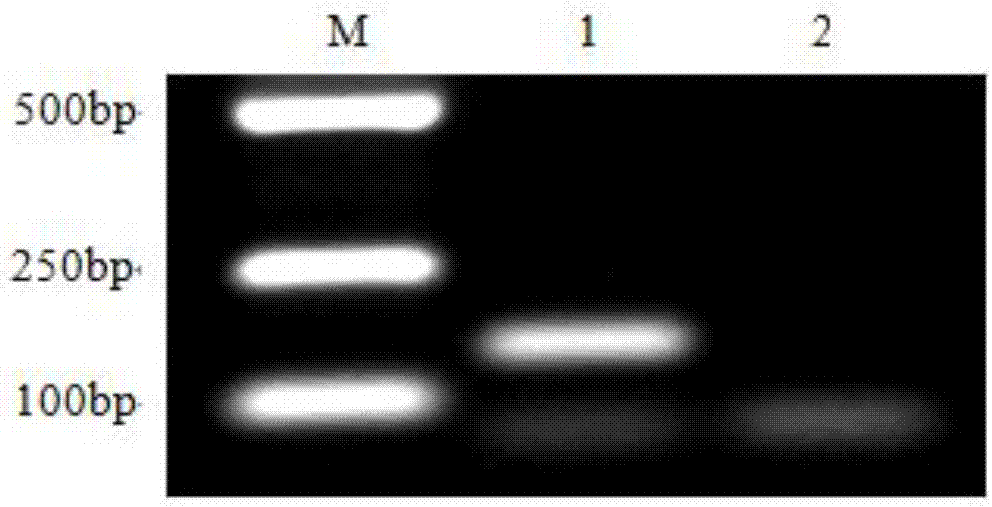 Fluorescent quantitative PCR (polymerase chain reaction) detection method for bee paenibacillus larvae TaqMan