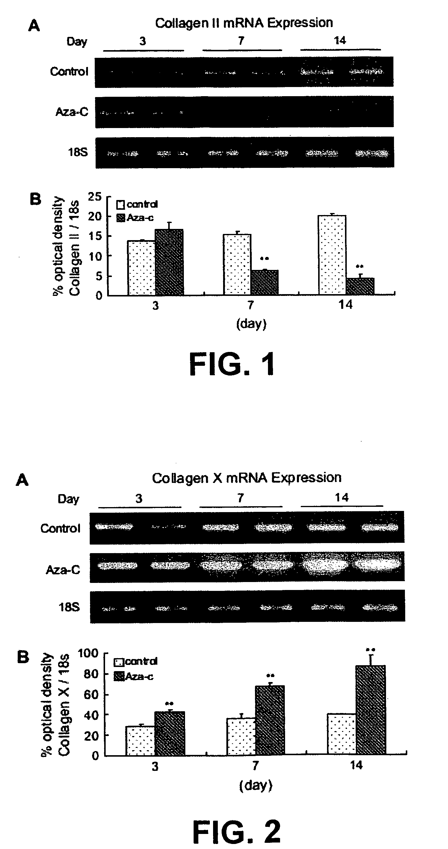 Three-dimensional culture containing human articular chondrocytes with induced terminal differentiation changes, and preparation process and uses of the same