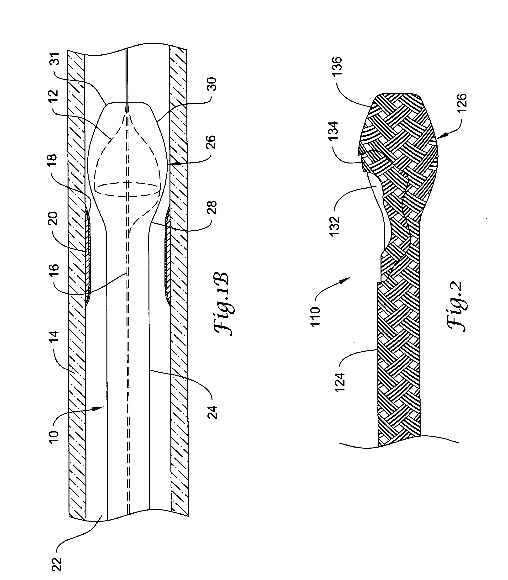 Sheath for use with an embolic protection filtering device