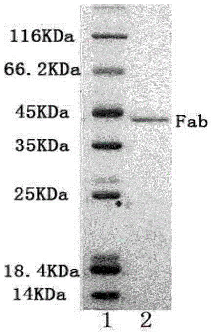 Method for separating human chorionic gonadotropin monoclonal antibody segment