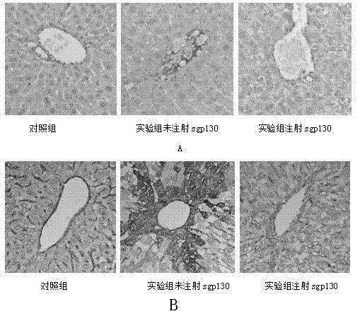 Gp130 extracellular domain protein as well as production method and application thereof